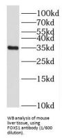 Forkhead Box Protein S1 (FOXS1) Antibody