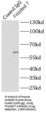 Frizzled 7 (FZD7) Antibody