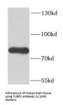 Far Upstream Element (FUSE) Binding Protein 1 (FUBP1) Antibody