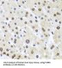Far Upstream Element (FUSE) Binding Protein 1 (FUBP1) Antibody