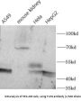 Alpha-(1,6)-Fucosyltransferase (FUT8) Antibody