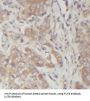 Alpha-(1,6)-Fucosyltransferase (FUT8) Antibody
