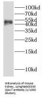 Galactose-1-Phosphate Uridylyltransferase (GALT) Antibody