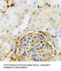 Galactose-1-Phosphate Uridylyltransferase (GALT) Antibody