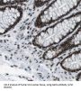 H/ACA Ribonucleoprotein Complex Subunit 1 (GAR1) Antibody