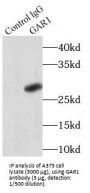 H/ACA Ribonucleoprotein Complex Subunit 1 (GAR1) Antibody