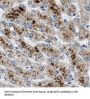 Glutamyl-tRNA(Gln) Amidotransferase Subunit C, Mitochondrial (GATC) Antibody