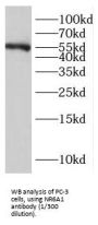 Nuclear Receptor Subfamily 6 Group A Member 1 (NR6A1) Antibody