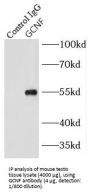 Nuclear Receptor Subfamily 6 Group A Member 1 (NR6A1) Antibody