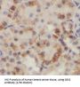 GDP Dissociation Inhibitor 2 (GDI2) Antibody