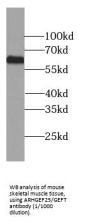 Rho Guanine Nucleotide Exchange Factor 25 / GEFT (ARHGEF25) Antibody