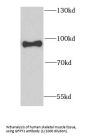 Glutamine Fructose-6-Phosphate Transaminase 1 (GFPT1) Antibody