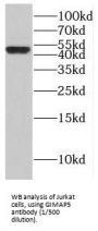 GTPase IMAP Family Member 5 (GIMAP5) Antibody