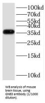 Guanine Nucleotide-Binding Protein G(I)/G(S)/G(T) Subunit Beta-3 (GNB3) Antibody