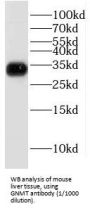 Glycine N-Methyltransferase (GNMT) Antibody