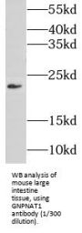 Glucosamine-Phosphate N-Acetyltransferase 1 (GNPNAT1) Antibody
