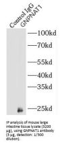 Glucosamine-Phosphate N-Acetyltransferase 1 (GNPNAT1) Antibody