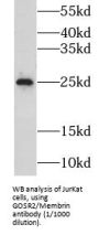 Golgi Snap Receptor Complex Member 2 (GOSR2) Antibody