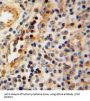 Granzyme A (GZMA) Antibody