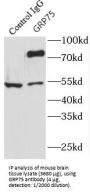 Stress-70 Protein, Mitochondrial (HSPA9) Antibody