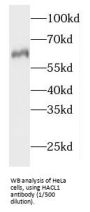 2-Hydroxyacyl-CoA Lyase 1 (HACL1) Antibody