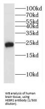 Heme-Binding Protein 2 (HEBP2) Antibody