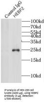 Heme-Binding Protein 2 (HEBP2) Antibody