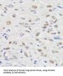 Non-Histone Chromosomal Protein HMG-14 (HMGN1) Antibody