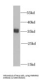 Heterogeneous Nuclear Ribonucleoprotein A0 (HNRNPA0) Antibody