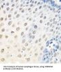 Heterogeneous Nuclear Ribonucleoprotein A0 (HNRNPA0) Antibody
