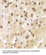 Heterogeneous Nuclear Ribonucleoprotein A1 (HNRNPA1) Antibody
