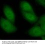 Heterogeneous Nuclear Ribonucleoprotein A3 (HNRNPA3) Antibody