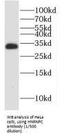 Heterogeneous Nuclear Ribonucleoprotein C1/C2 (HNRNPC) Antibody