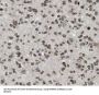 Heterogeneous Nuclear Ribonucleoprotein C1/C2 (HNRNPC) Antibody
