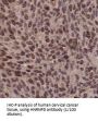 Heterogeneous Nuclear Ribonucleoprotein D (HNRNPD) Antibody