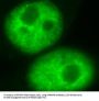 Heterogeneous Nuclear Ribonucleoprotein D (HNRNPD) Antibody