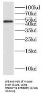 Heterogeneous Nuclear Ribonucleoprotein H (HNRNPH1) Antibody