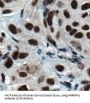 Heterogeneous Nuclear Ribonucleoprotein H (HNRNPH1) Antibody