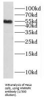 Heterogeneous Nuclear Ribonucleoprotein K (HNRNPK) Antibody