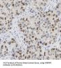 Heterogeneous Nuclear Ribonucleoprotein K (HNRNPK) Antibody