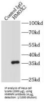 Heterogeneous Nuclear Ribonucleoprotein K (HNRNPK) Antibody