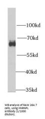 Heterogeneous Nuclear Ribonucleoprotein L (HNRNPL) Antibody