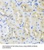 Heterogeneous Nuclear Ribonucleoprotein L (HNRNPL) Antibody