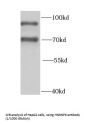 Heterogeneous Nuclear Ribonucleoprotein R (HNRNPR) Antibody
