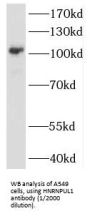 Heterogeneous Nuclear Ribonucleoprotein U-Like Protein 1 (HNRNPUL1) Antibody