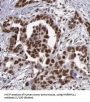 Heterogeneous Nuclear Ribonucleoprotein U-Like Protein 1 (HNRNPUL1) Antibody