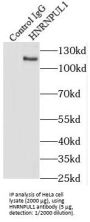 Heterogeneous Nuclear Ribonucleoprotein U-Like Protein 1 (HNRNPUL1) Antibody