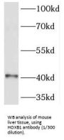 Homeobox Protein Hox-B1 (HOXB1) Antibody