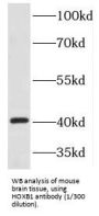 Homeobox Protein Hox-B1 (HOXB1) Antibody