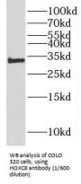 Homeobox Protein Hox-C8 (HOXC8) Antibody